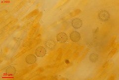 Ramsbottomia asperior