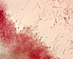 Hygrocybe subminiata