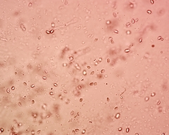 Hygrocybe subminiata