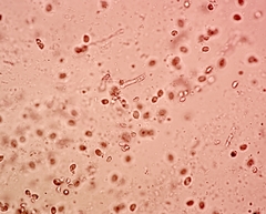 Hygrocybe subminiata