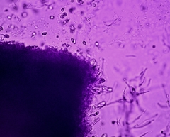 Hygrocybe subminiata