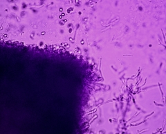 Hygrocybe subminiata