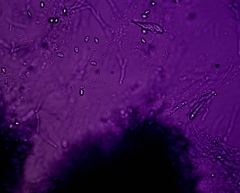 Hygrocybe subminiata