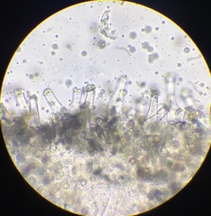 Inocybe margaritispora