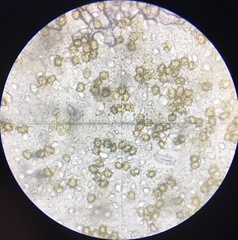 Inocybe margaritispora