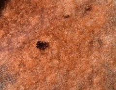 Schizoporella pungens