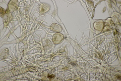 Peronospora sordida