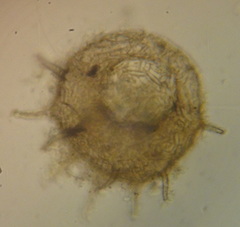Centropyxis aculeata