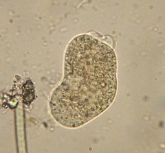 Hartmannellidae