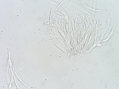 Dermea stellata