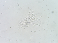 Dermea stellata