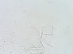 Dermea stellata