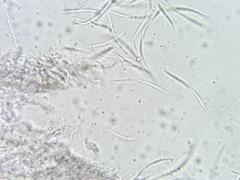 Dermea stellata