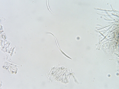 Dermea stellata