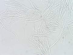 Dermea stellata