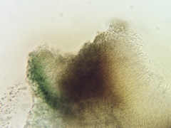 Dermea stellata