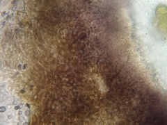 Dermea stellata