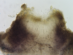 Dermea stellata