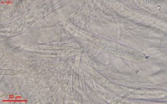 Arachnopeziza delicatula
