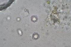 Octospora maireana
