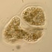 Microcystis wesenbergii - Photo (c) Natalie Flores, some rights reserved (CC BY-NC), uploaded by Natalie Flores