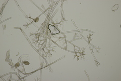 Pseudoperonospora cubensis