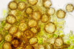 Peronospora lathyri-verni