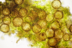 Peronospora lathyri-verni