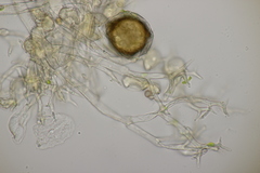 Peronospora lathyri-verni
