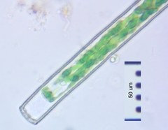 Pleurotaenium