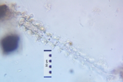Triploceras gracile