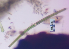 Closterium angustatum