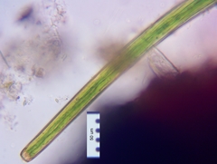 Closterium angustatum