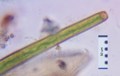 Closterium angustatum
