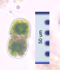 Actinotaenium cucurbita