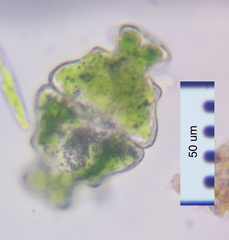 Euastrum ampullaceum