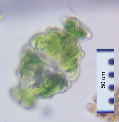 Euastrum ampullaceum