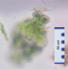 Euastrum ampullaceum