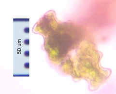 Euastrum ampullaceum