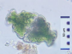 Euastrum ampullaceum