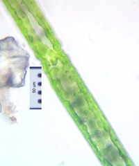 Pleurotaenium trabecula