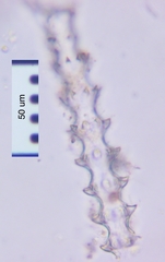 Triploceras gracile