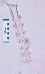 Triploceras gracile
