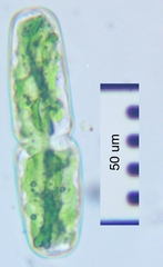 Actinotaenium crassiusculum