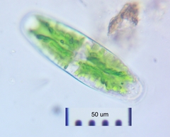 Netrium digitus