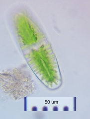 Netrium digitus