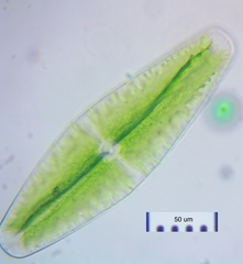 Netrium digitus