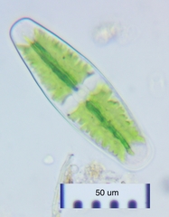 Netrium digitus