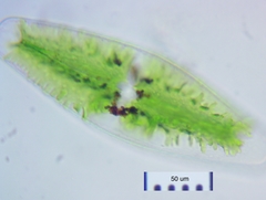 Netrium digitus