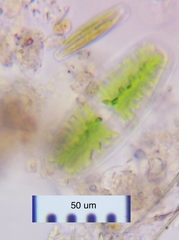 Netrium digitus